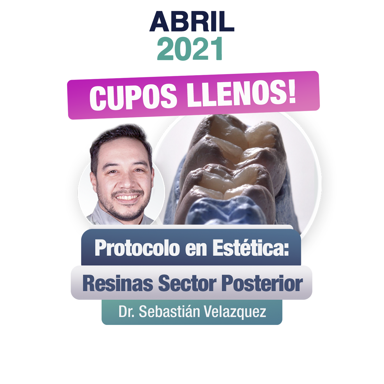 ABRIL 2021 PROTOCOLO EN ESTETICA POSTERIOR