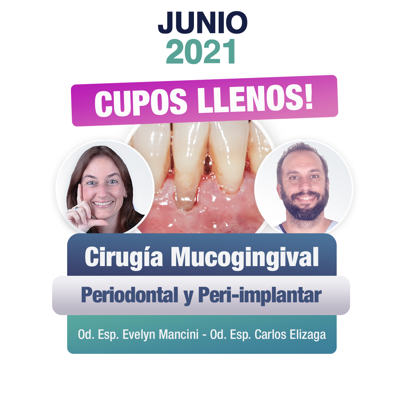 JUNIO 2021 CIRUGIA MUCOGINGIVAL