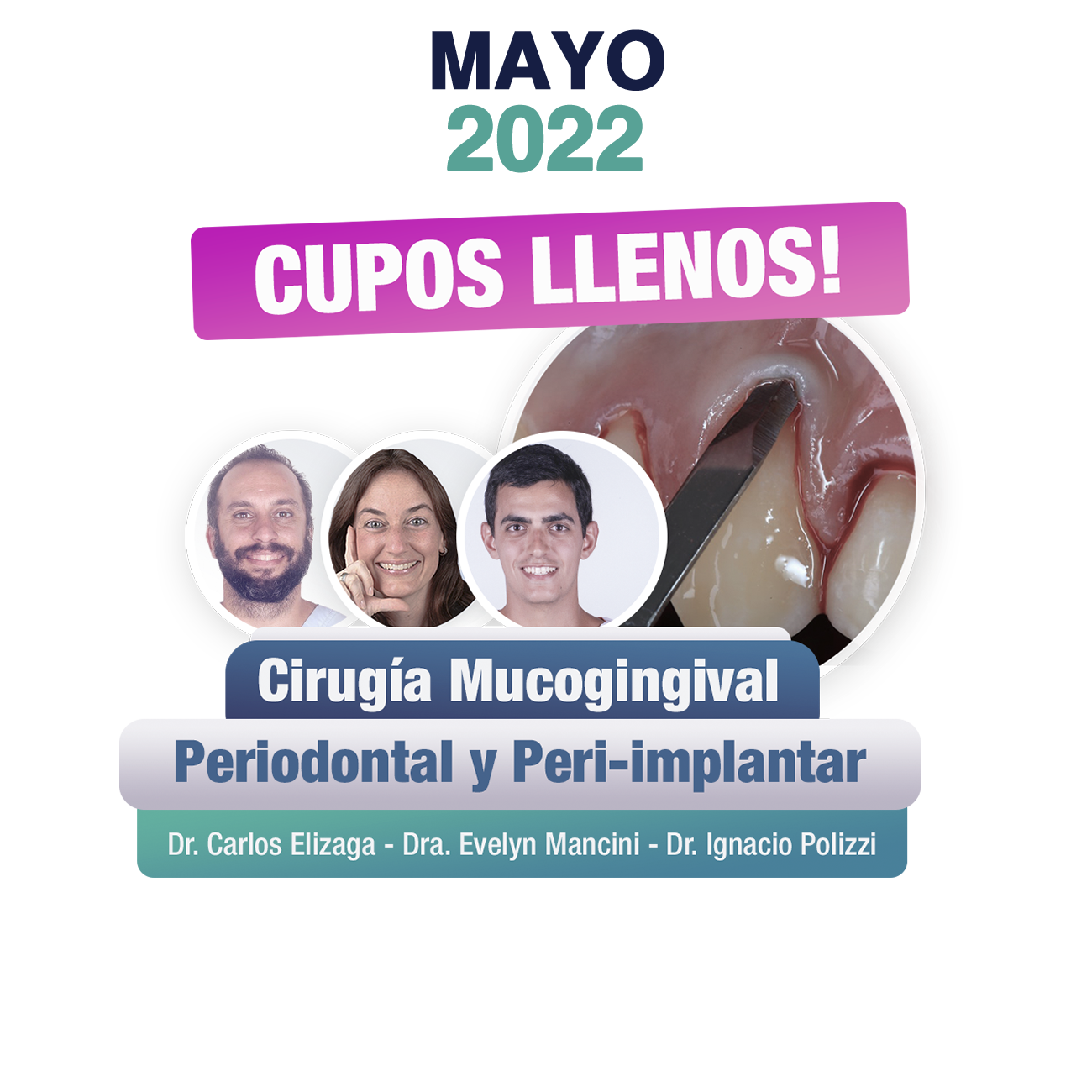 MAYO CIRUGIA MUCOGINGIVAL 2022
