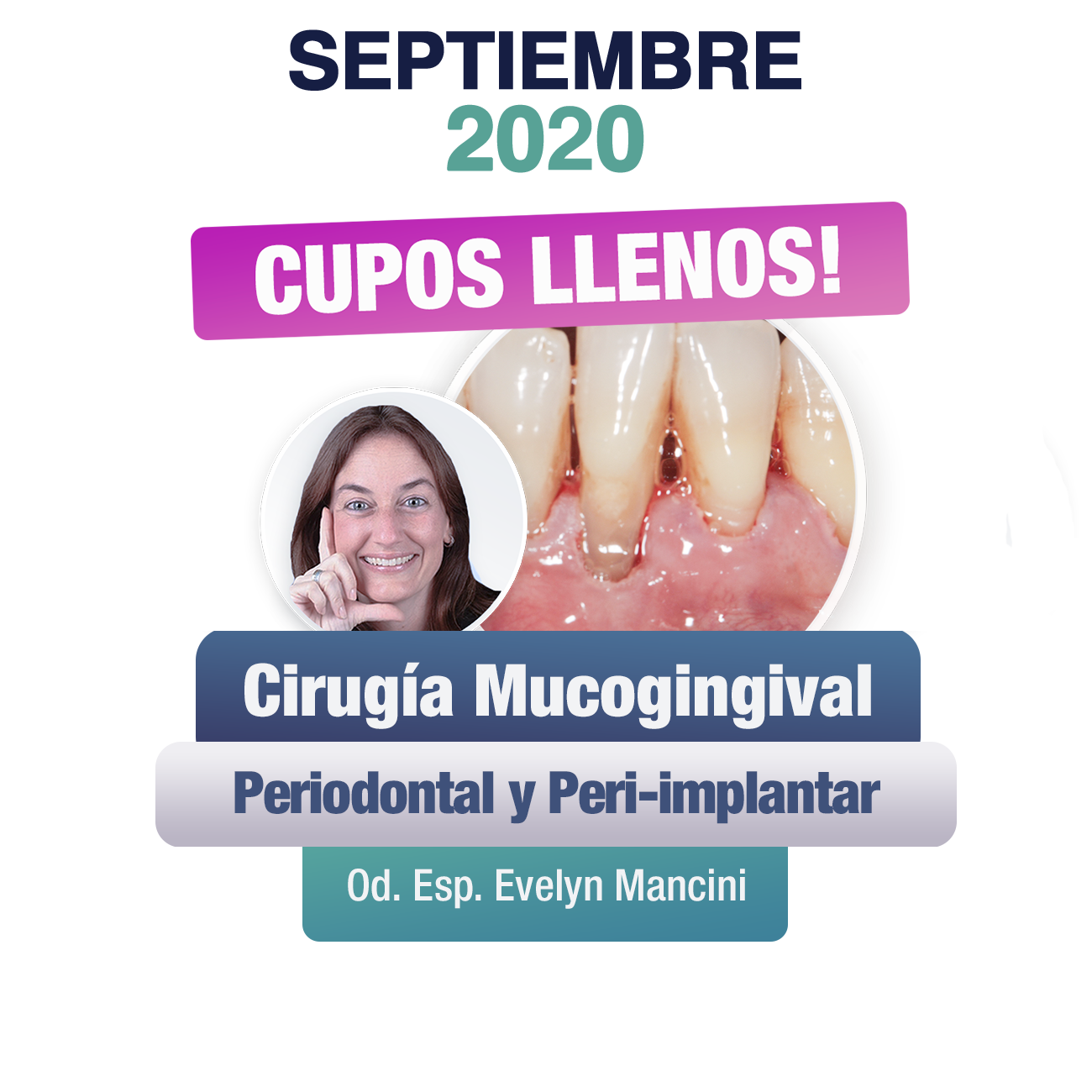 SEPTIEMBRE 2020 CIRUGIA MUCOGINGIVAL