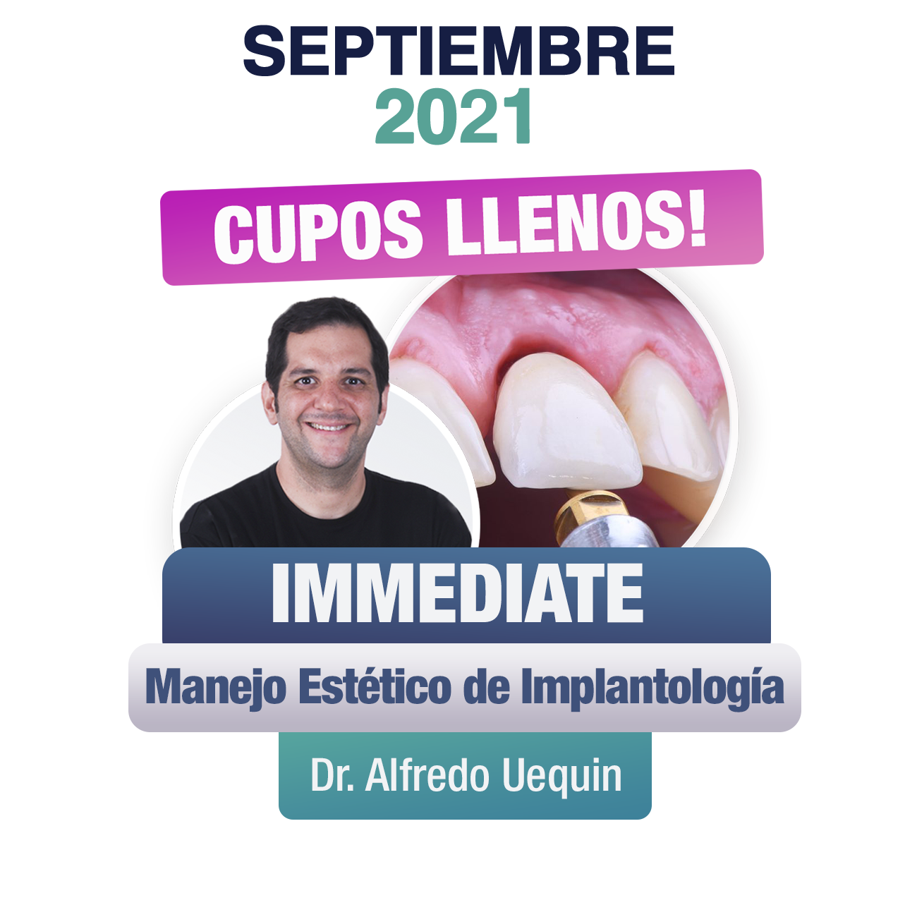 SEPTIEMBRE IMMEDIATE UEQUIN 2021