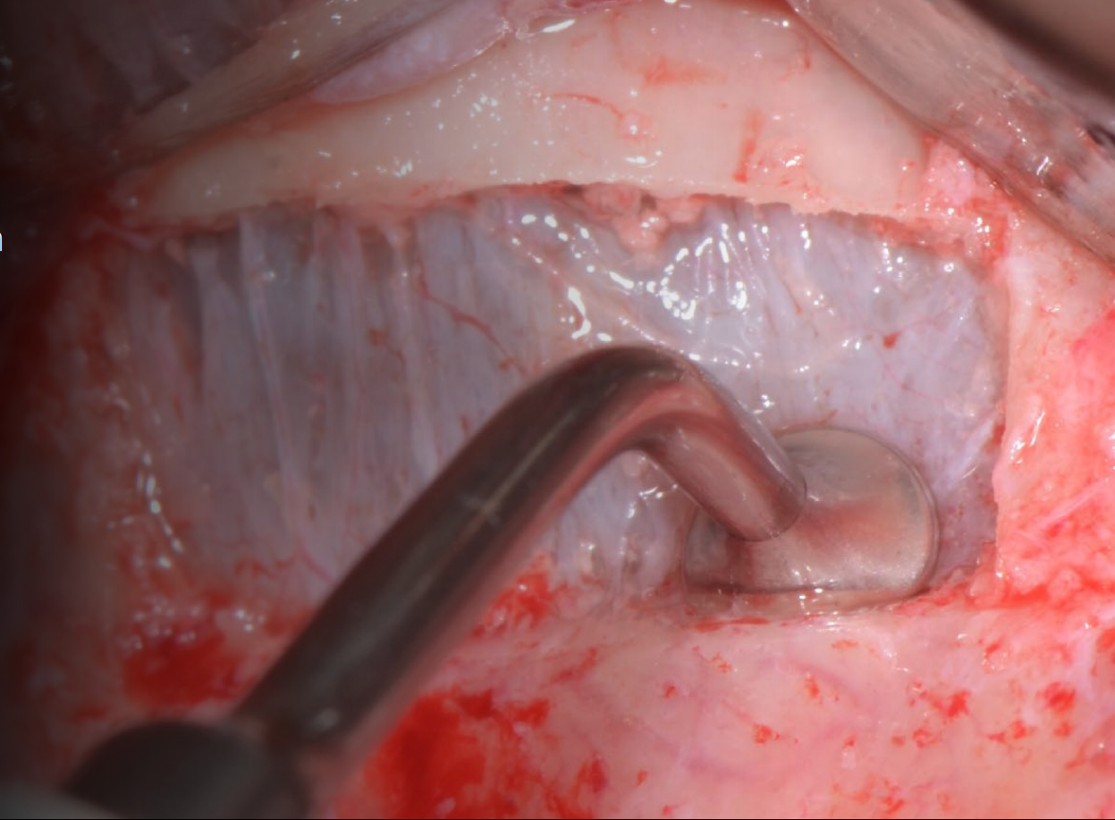 ALFREDO UEQUIN !  Sinus Experience