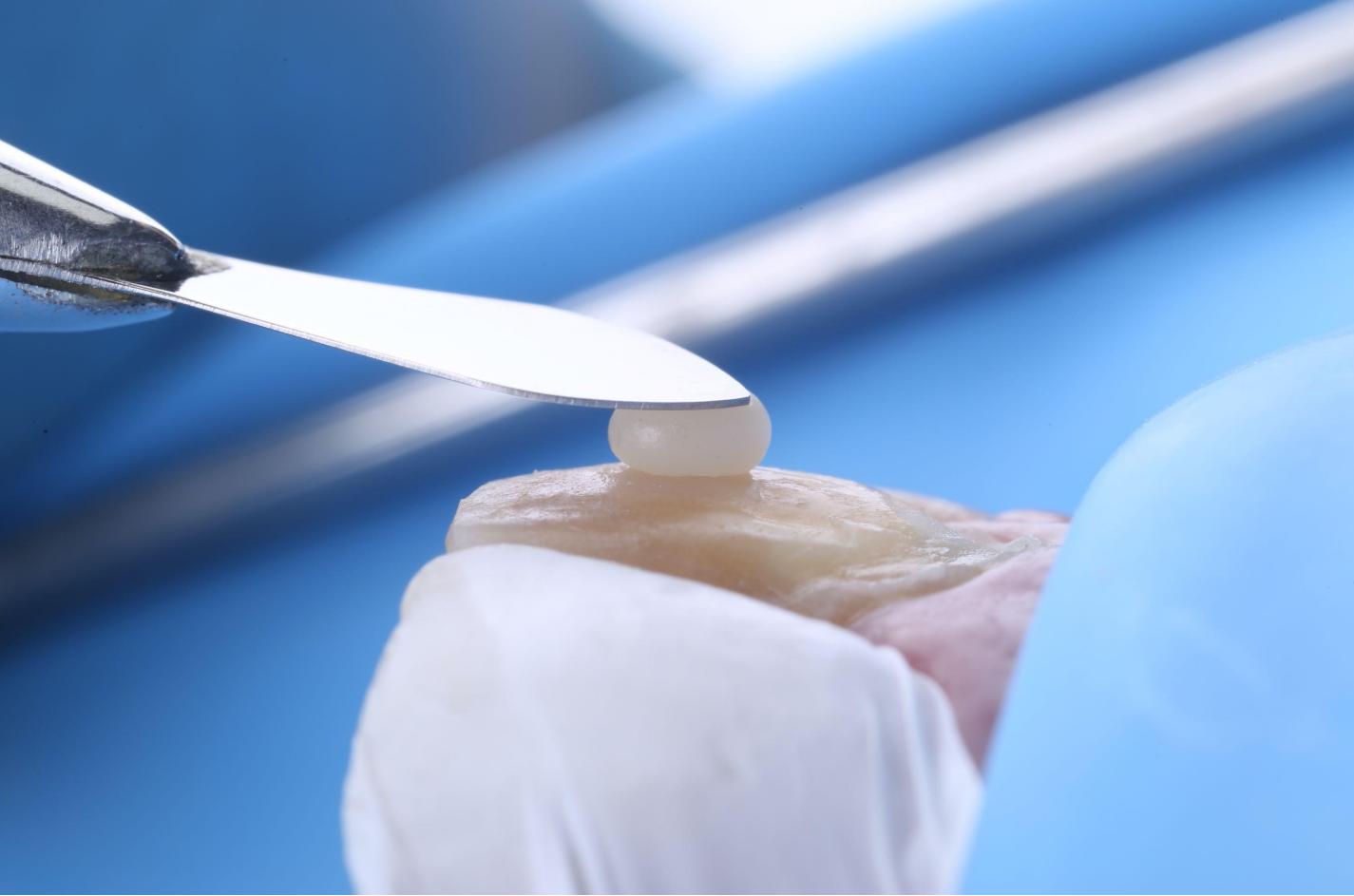 PROTOCOLO EN ESTÉTICA – Resinas Sector Anterior